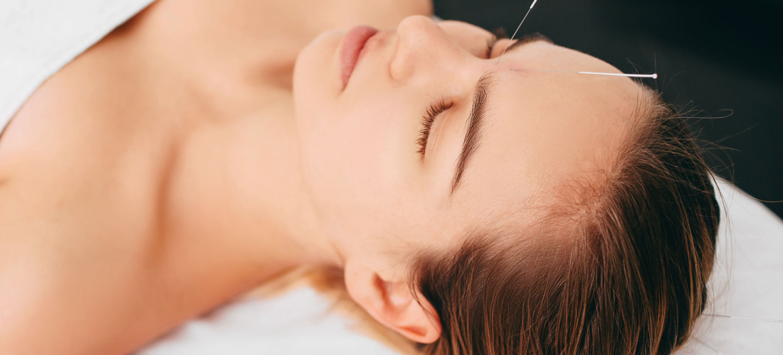 Acupuncteur à Lyon : comment trouver le bon praticien sans se tromper ? 